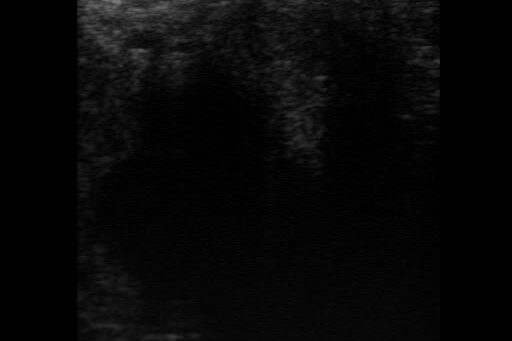 Renegade 2 week (1) (1)