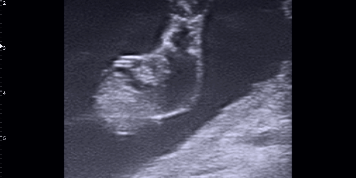 20240830001_20240924082141712