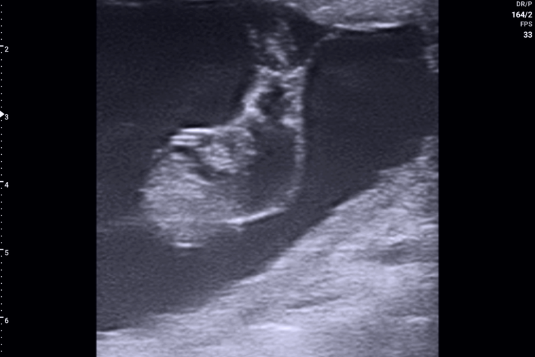 20240830001_20240924082141712